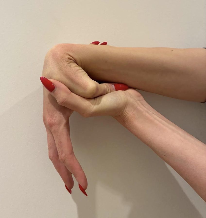 A hand with the thumb bent back to touch the forearm, part of the Beighton test